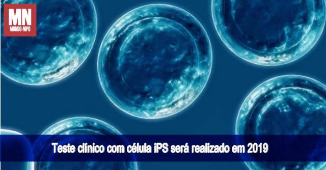 Célula iPS