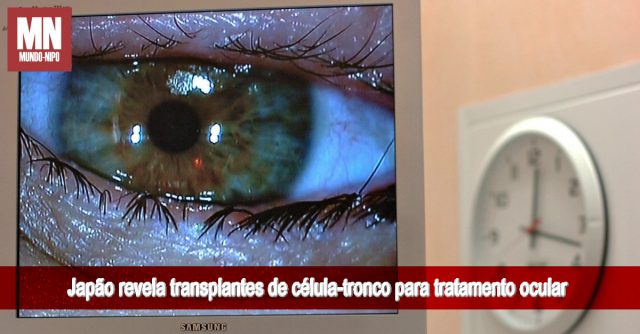 5 Público
