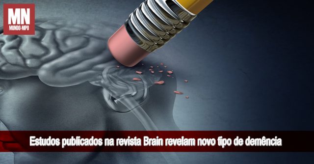 1 Brain