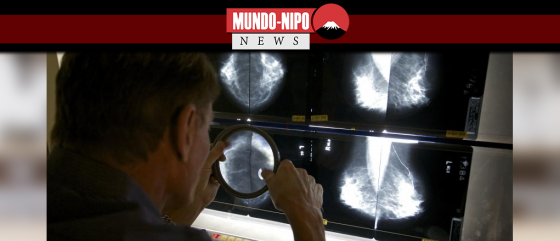 Um radiologista verifica mamografias em Los Angeles.
