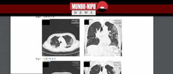 Frame da reportagem realizada pela NHK mostra um pulmão em tratamento