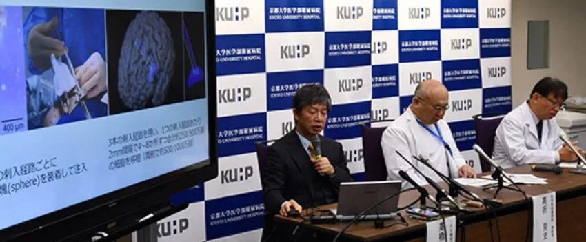 Pesquisadores de Kyoto avançam no tratamento com células iPS para Parkinson, oferecendo nova esperança aos pacientes. Veja os resultados do estudo.