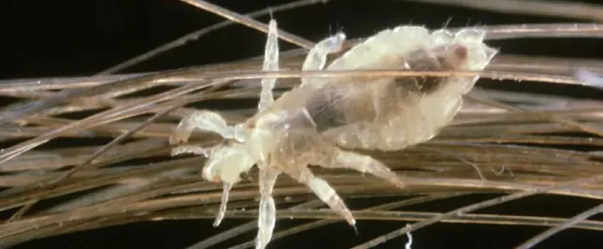 Surto de piolhos em Sapporo preocupa após a pandemia. Saiba como identificar, prevenir e tratar a infestação. Informações importantes para amantes do Japão e descendentes.