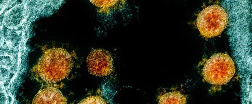 Aumento dos casos semanais de COVID‑19 no Japão preocupa. Cenário atual, variantes e incidência por região. Informação essencial para quem ama o Japão.