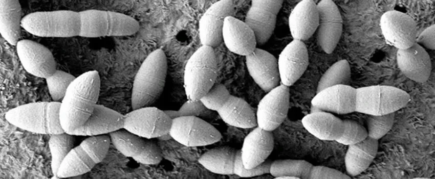 Descubra como uma bactéria intestinal japonesa pode aumentar a eficácia da imunoterapia contra o câncer e transformar o tratamento oncológico.
