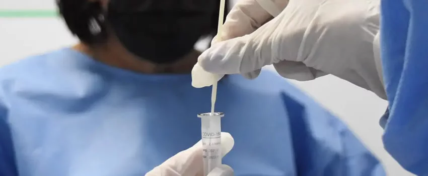 Mais da metade dos pacientes em Okayama tratam a COVID longa por 180 dias ou mais. Saiba o que o Hospital Universitário de Okayama descobriu sobre os sintomas persistentes e a variante Nimbus.